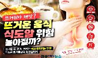 “뜨거워야 제맛?” 뜨거운 국·찌개·커피 자주 먹으면 식도암 위험 높아질까